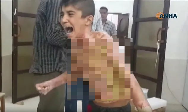 Những đứa trẻ Syria bị trúng bom trong chiến sự dữ dội của Thổ Nhĩ Kỳ