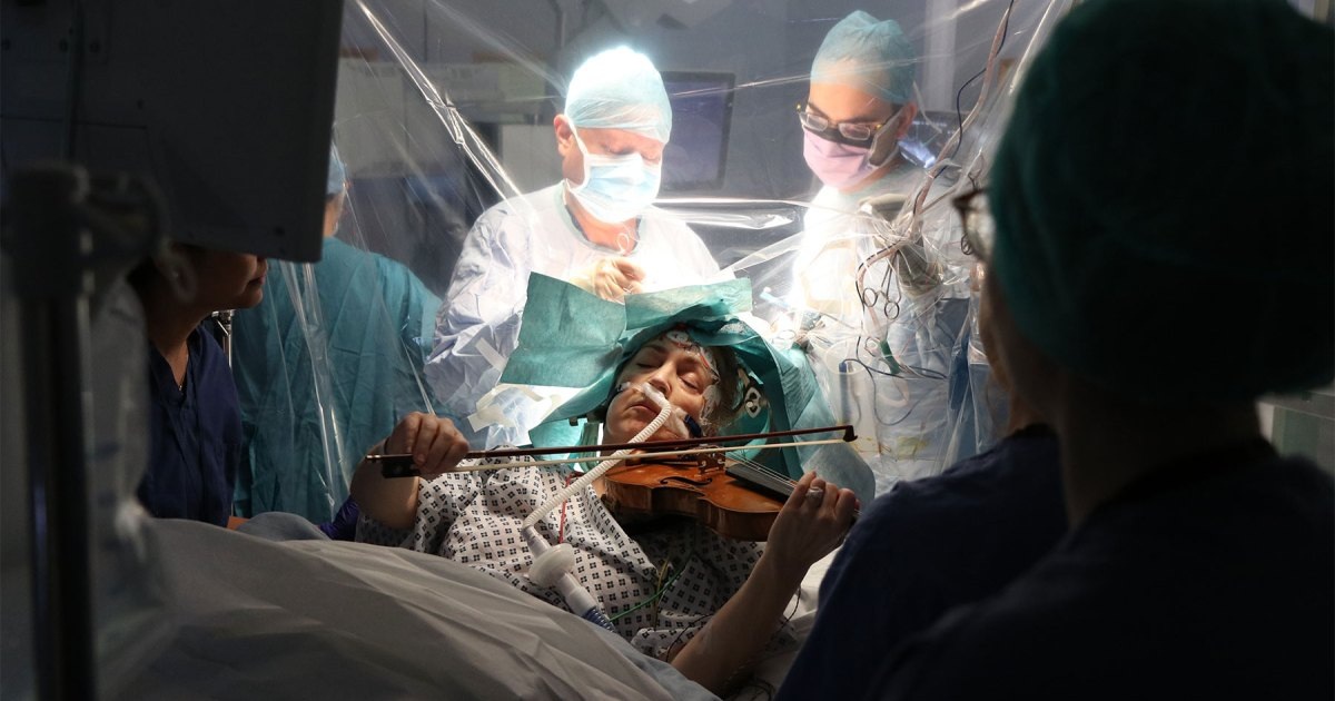 Video bệnh nhân chơi vĩ cầm trong lúc bác sĩ phẫu thuật cắt u não