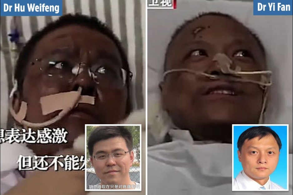 Hai bác sĩ Trung Quốc đổi màu da vì mắc Covid-19