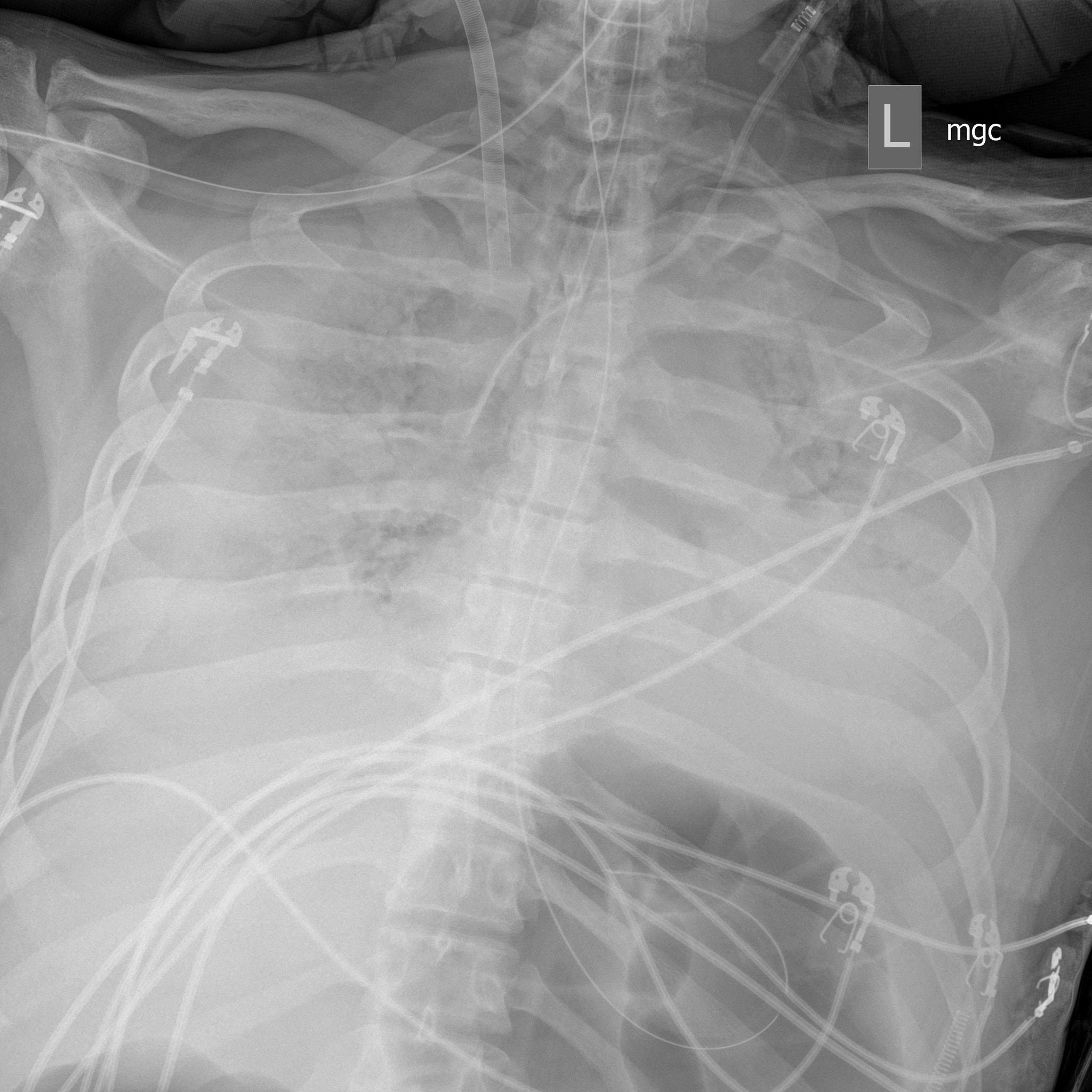 Hành trình trở về từ cõi chết của luật sư Mỹ mắc Covid-19