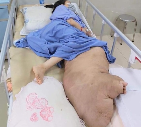 Đằng sau những mũi dao phẫu thuật tạo hình làm thay đổi số phận người bệnh - 5 Đằng sau những mũi dao phẫu thuật tạo hình làm thay đổi số phận người bệnh - 5