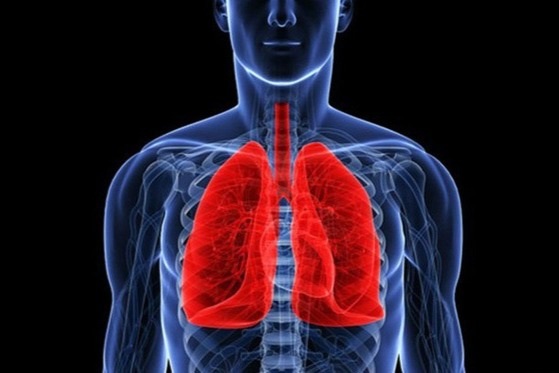 Ung thư phổi khó phát hiện sớm, cần chú ý 5 triệu chứng này - 1