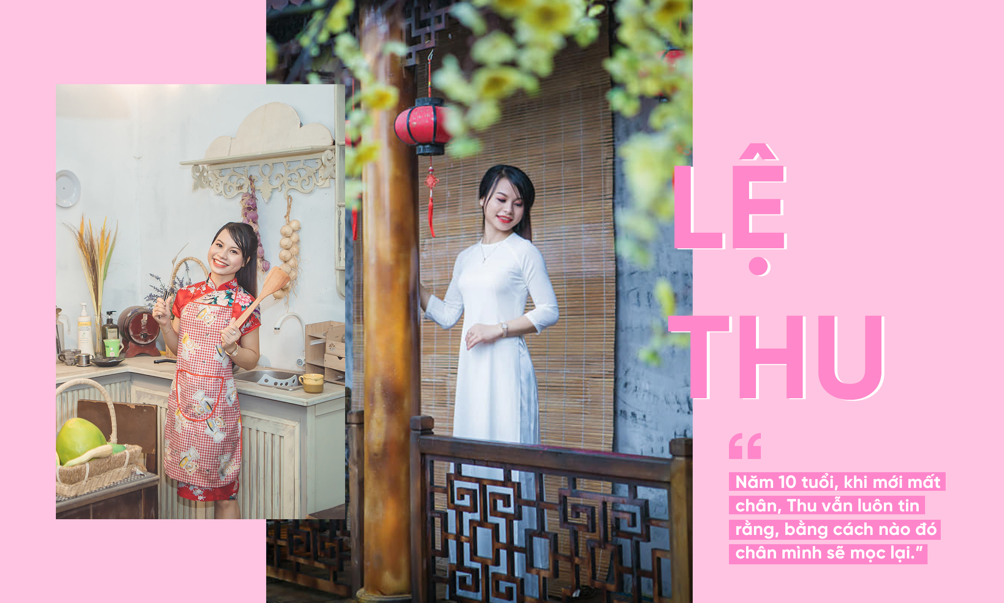 Tình yêu đặc biệt của cặp vợ chồng lính chì, mỗi người có một chân ở Hà Nội - 3 Tình yêu đặc biệt của cặp vợ chồng lính chì, mỗi người có một chân ở Hà Nội - 3