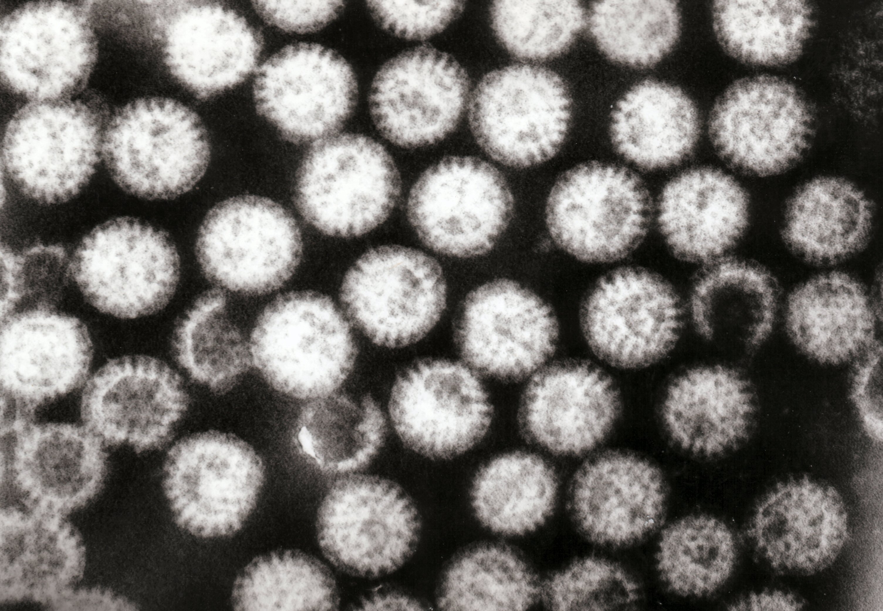12 loại virus đáng sợ nhất trong lịch sử loài người - 24