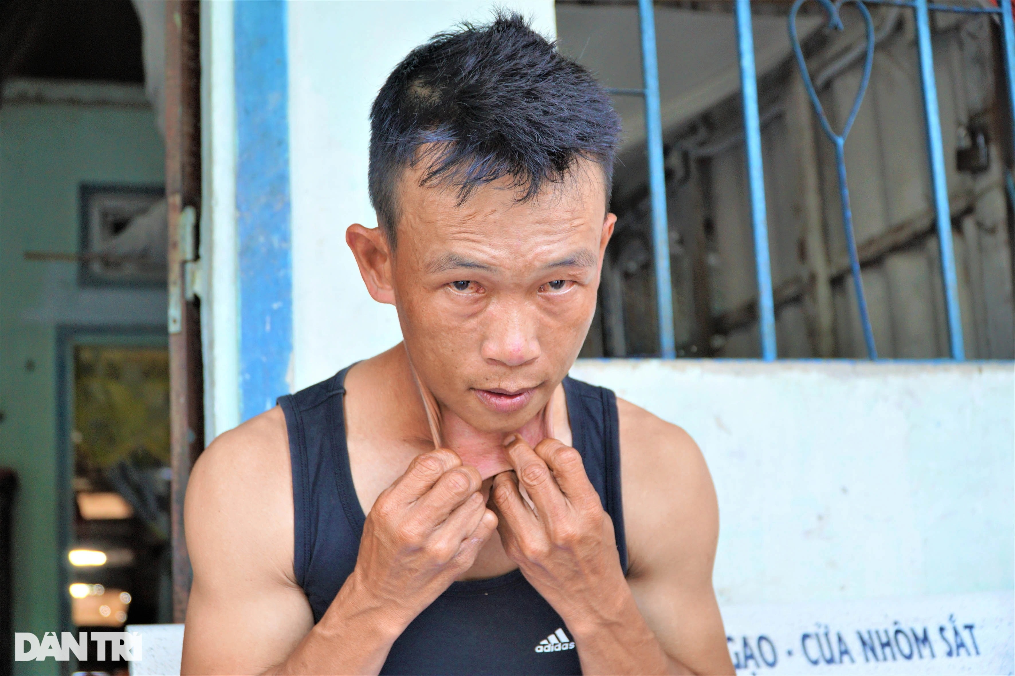 Người đàn ông miền Tây có làn da kéo giãn như cao su tay chân bẻ gập 180 độ - 2