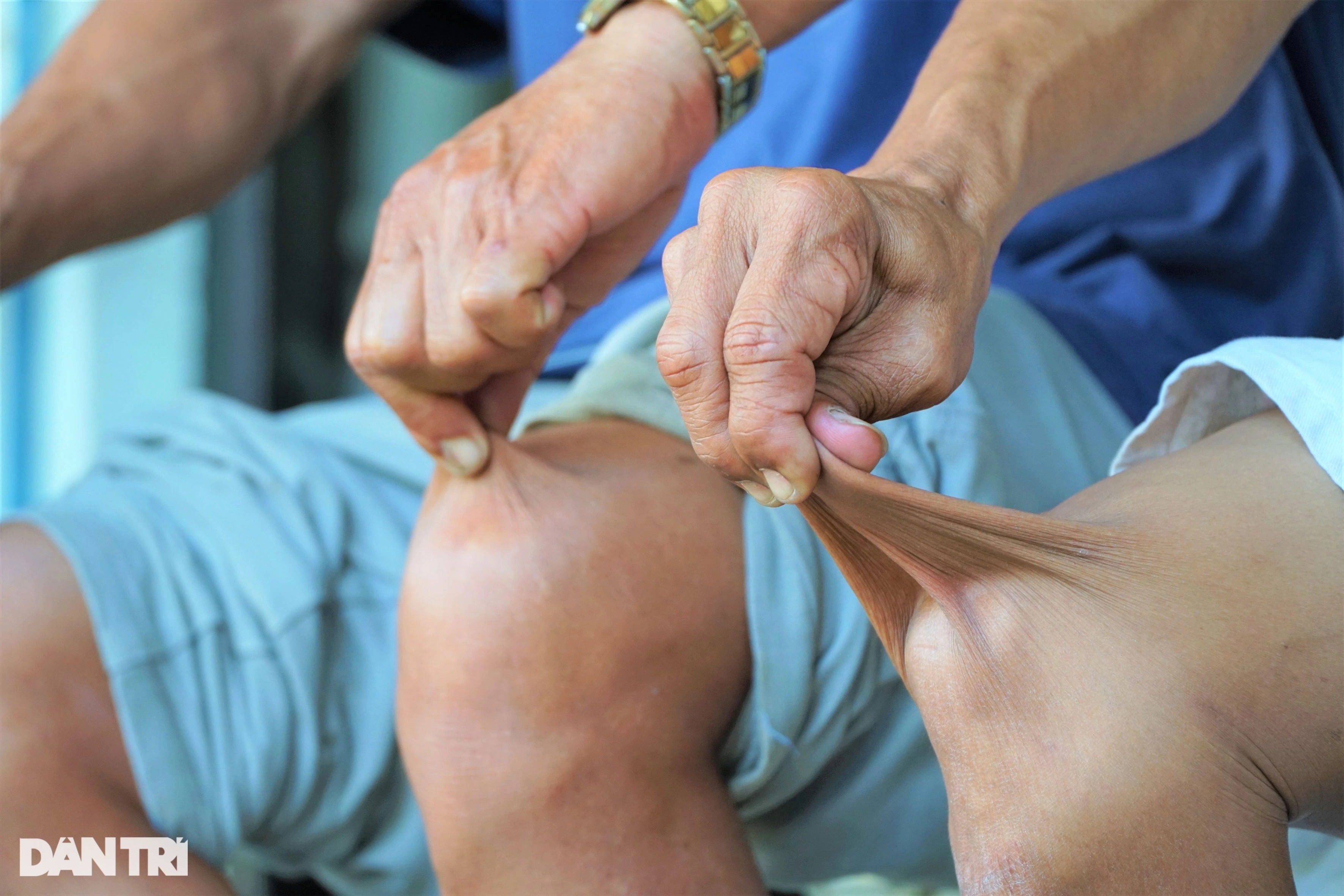Người đàn ông miền Tây có làn da kéo giãn như cao su tay chân bẻ gập 180 độ - 9