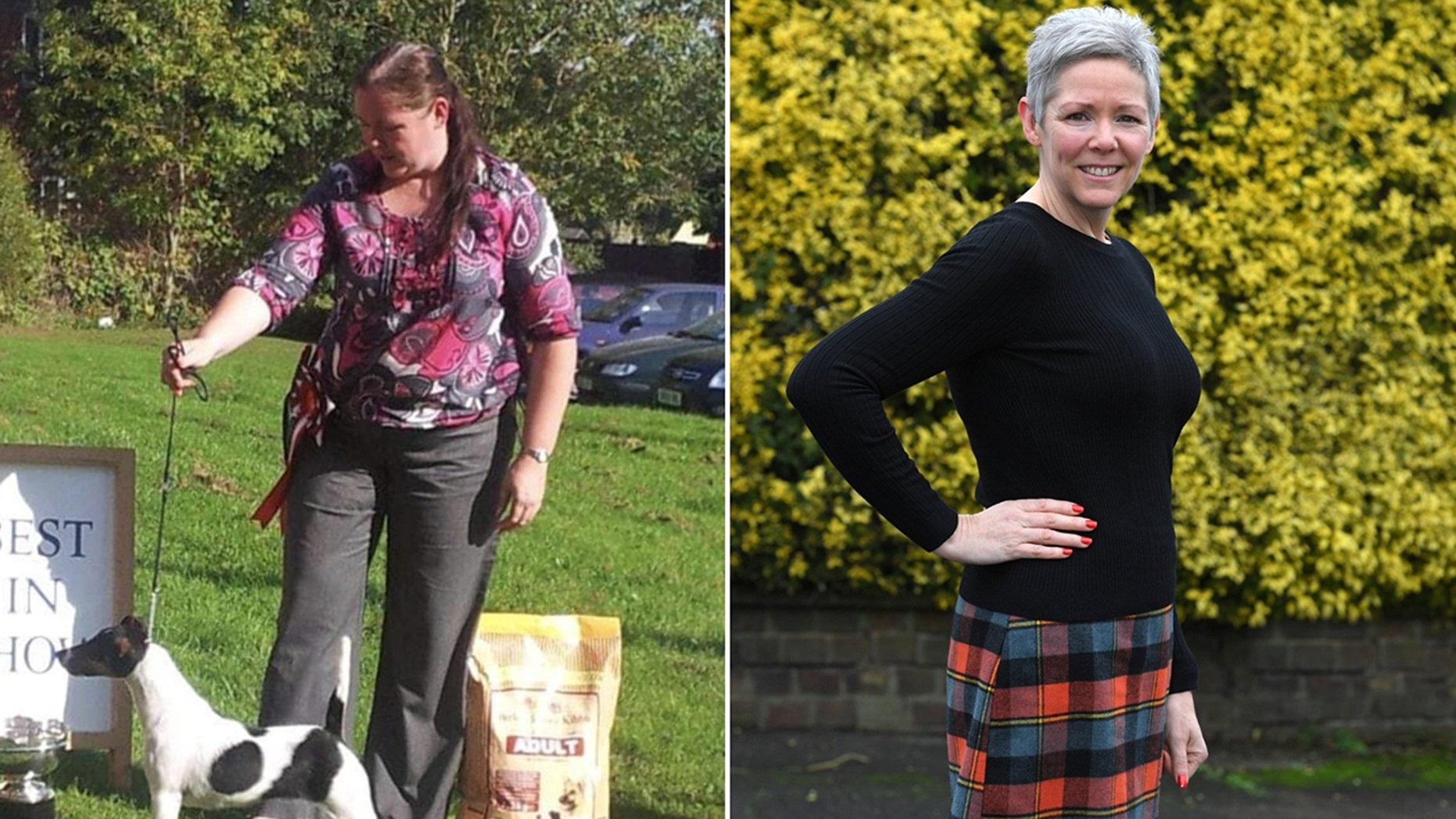 Giảm 25kg trong 6 tháng giúp người phụ nữ phát hiện sớm ung thư - 1