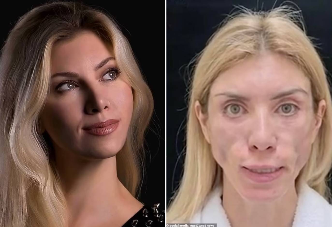 Morberplz Plastic Surgery