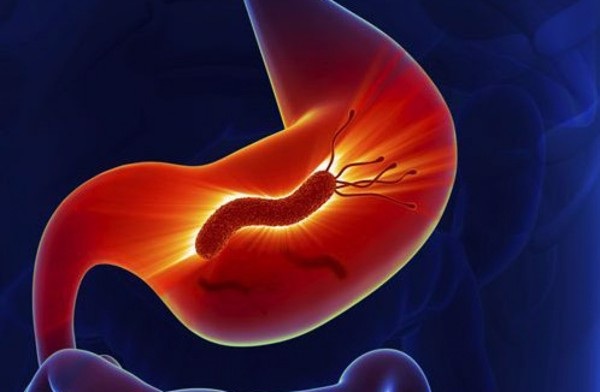 Tình trạng viêm có thể tiến triển thành ung thư trong bao lâu? - 1 Tình trạng viêm có thể tiến triển thành ung thư trong bao lâu? - 1