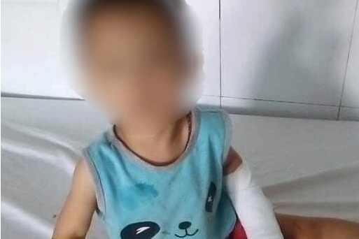 Bị gã điên vì tình cắt gân tay, cháu bé 4 tuổi thương tật 35% - 2