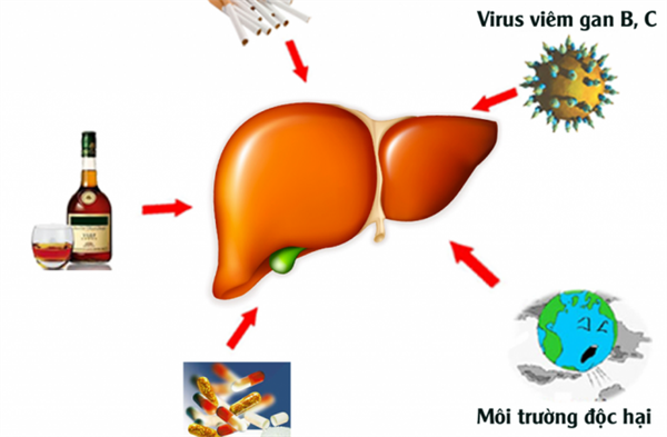 Các yếu tố làm tăng nguy cơ ung thư gan - 1