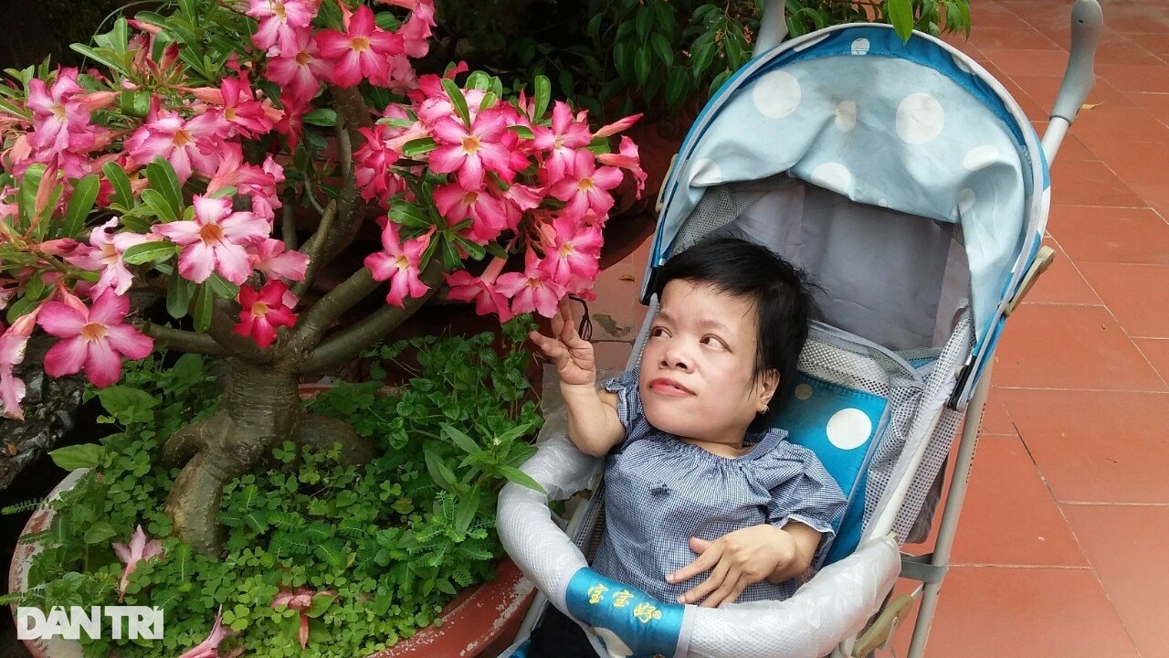 Cô gái Sọ Dừa với hành trình thành thủ lĩnh, diễn giả truyền cảm hứng - 3 Cô gái Sọ Dừa với hành trình thành thủ lĩnh, diễn giả truyền cảm hứng - 3