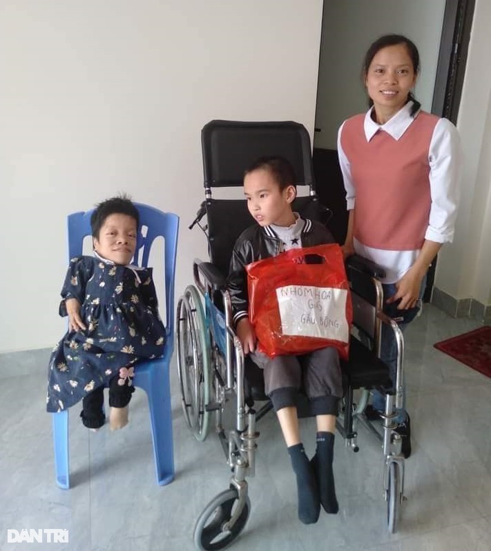 Cô gái Sọ Dừa với hành trình thành thủ lĩnh, diễn giả truyền cảm hứng - 7 Cô gái Sọ Dừa với hành trình thành thủ lĩnh, diễn giả truyền cảm hứng - 7
