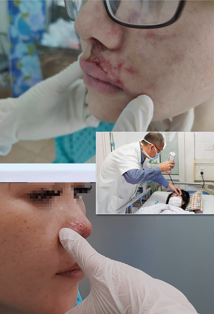 Mù mắt vì tiêm filler: Khi chị em đánh cược vào tiệm tóc, người quen - 10 Mù mắt vì tiêm filler: Khi chị em đánh cược vào tiệm tóc, người quen - 10