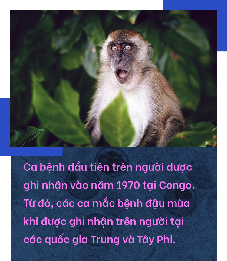 Đậu mùa khỉ: Vì sao căn bệnh bị xóa sổ 40 năm trước khiến WHO họp khẩn?