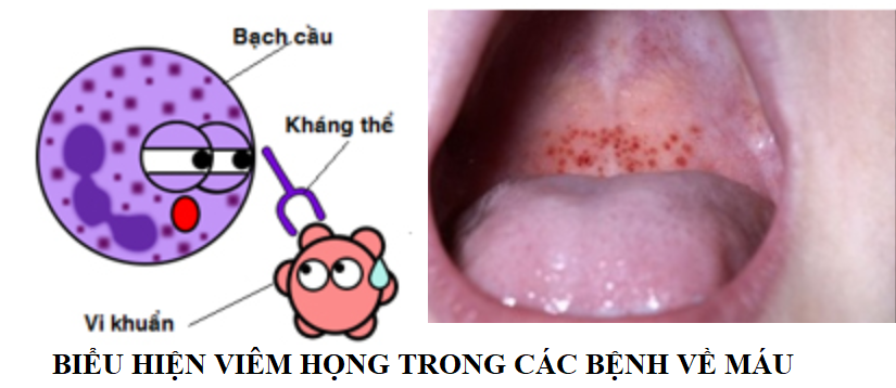 Chàng trai phát hiện ung thư nhờ dấu hiệu tưởng bệnh vặt này - 1