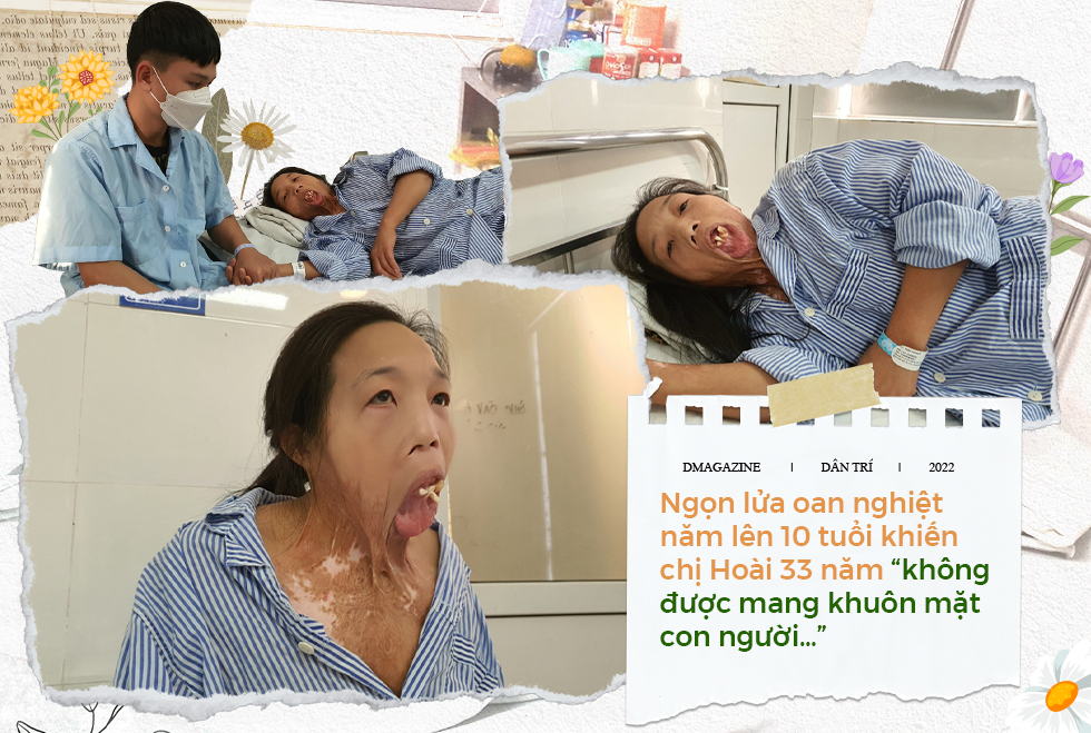 Người đàn bà 33 năm không được mang khuôn mặt con người hồi sinh kỳ diệu - 2 Người đàn bà 33 năm không được mang khuôn mặt con người hồi sinh kỳ diệu - 2
