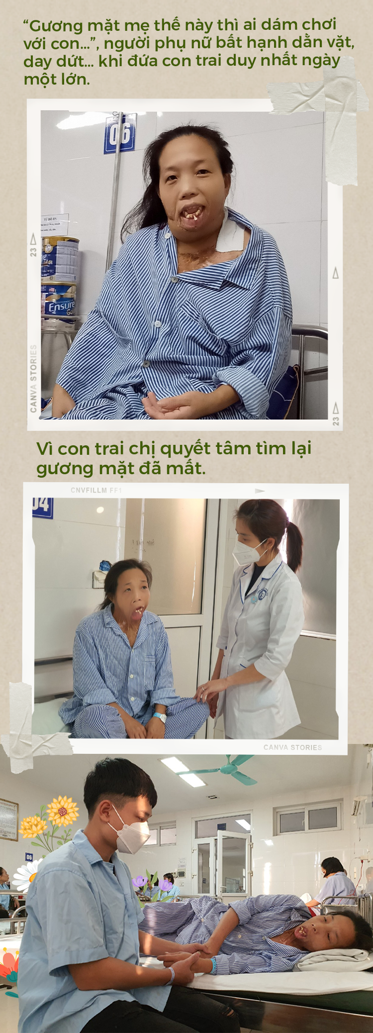 Người đàn bà 33 năm không được mang khuôn mặt con người hồi sinh kỳ diệu - 5 Người đàn bà 33 năm không được mang khuôn mặt con người hồi sinh kỳ diệu - 5
