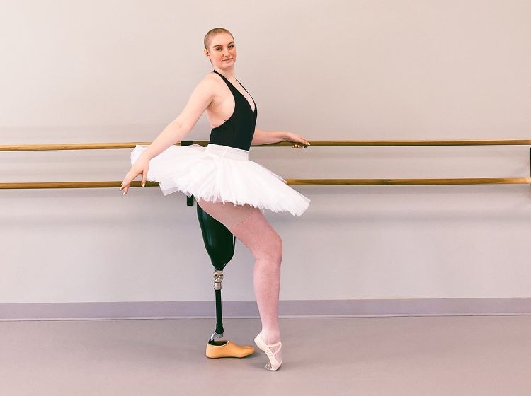 Nghị lực phi thường của vũ công 21 tuổi mắc ung thư, bị cắt một chân - 2
