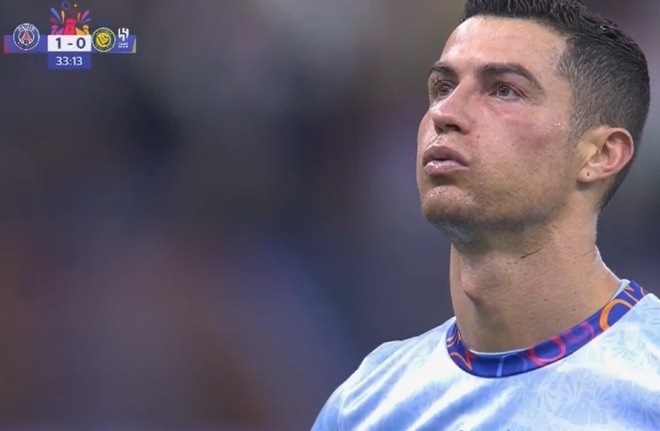 Hành động đáng yêu của Mbappe khi C.Ronaldo bị sưng mặt - 2