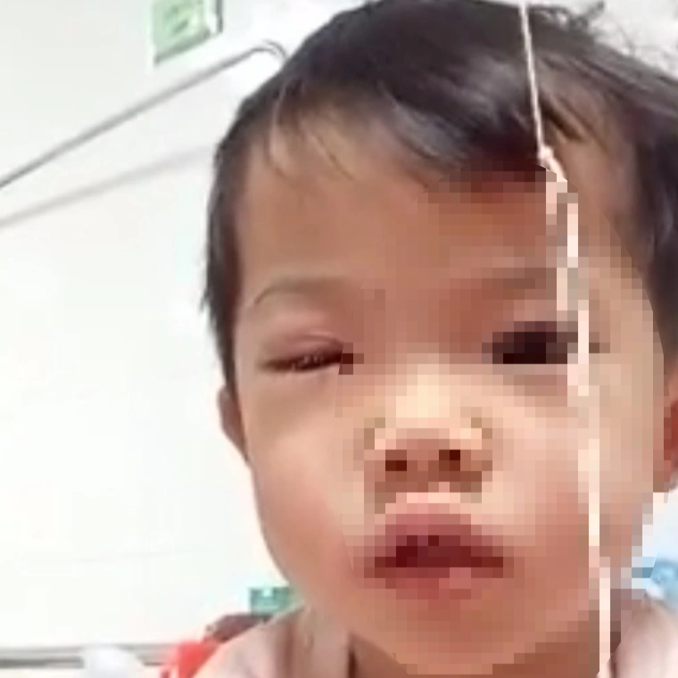 Bé gái 2 tuổi bị xịt hơi cay vào mắt trong vụ xô xát của người lớn - 2