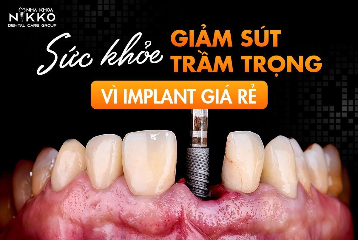 Những rủi ro khi cấy ghép implant giá rẻ - 1