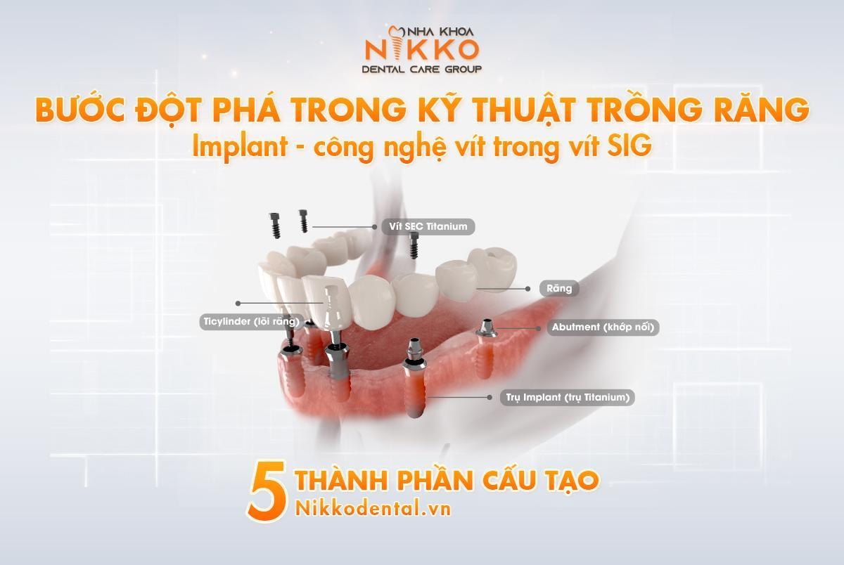 Những rủi ro khi cấy ghép implant giá rẻ - 3