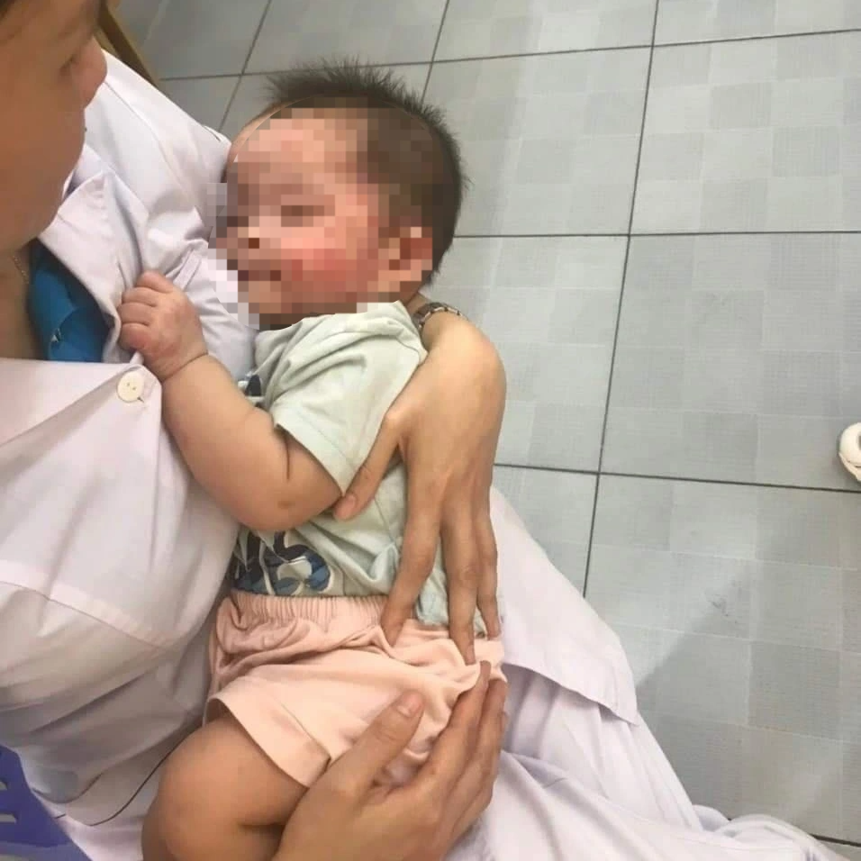Bé gái 7 tháng tuổi bị bỏ rơi bên đường, muỗi đốt kín mặt - 1