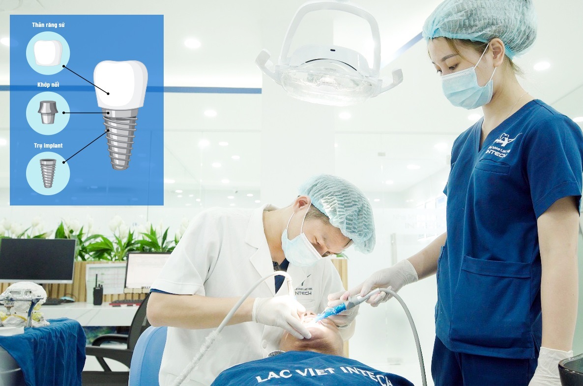Công nghệ phục hình răng sứ trên implant DCT - 1