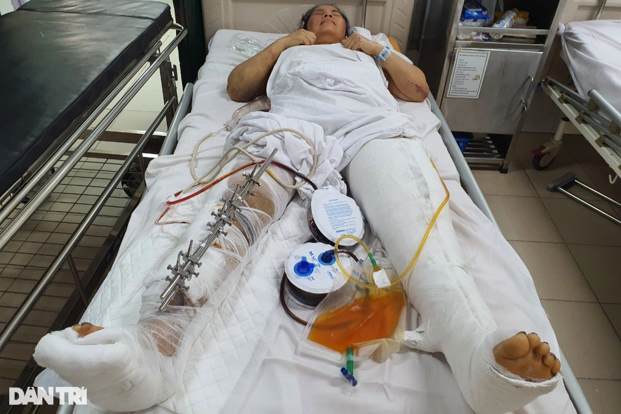 View - Nghiệt ngã số phận người phụ nữ bị tường gạch đổ đè lên người | Báo Dân trí