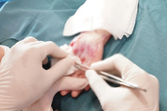 Tai nạn bất ngờ, 3 trẻ bị bỏng nặng vì máy chạy bộ tại nhà - 1