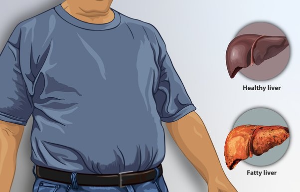 8 thứ không ngờ đang bào mòn lá gan của bạn từng ngày - 1