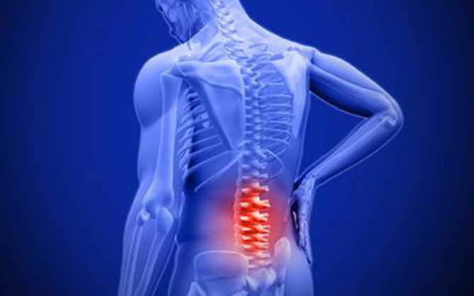 Viêm khớp cột sống dễ gây tàn phế | Chuyên trang Dân sinh