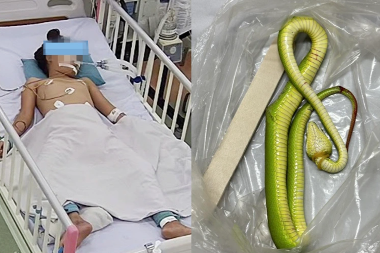 Nhiều trẻ bị rắn độc cắn nguy kịch ở nhà bếp, bụi cỏ