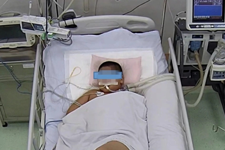 Bé trai 11 tuổi hoại tử, trụy tim mạch nguy kịch vì nhiễm khuẩn từ nốt nhọt