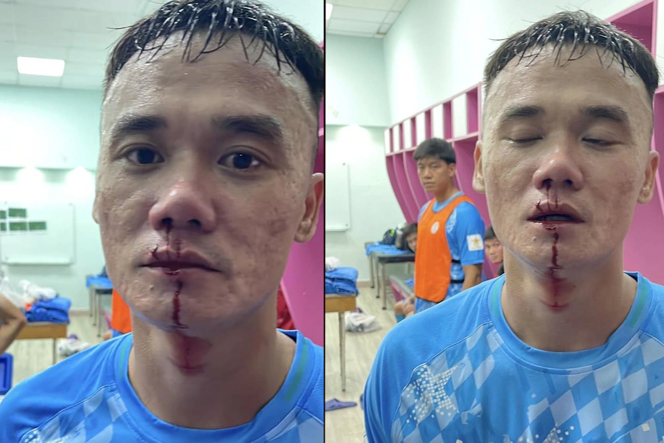 Người trong cuộc lên tiếng sau vụ ẩu đả ở sân Thống Nhất
