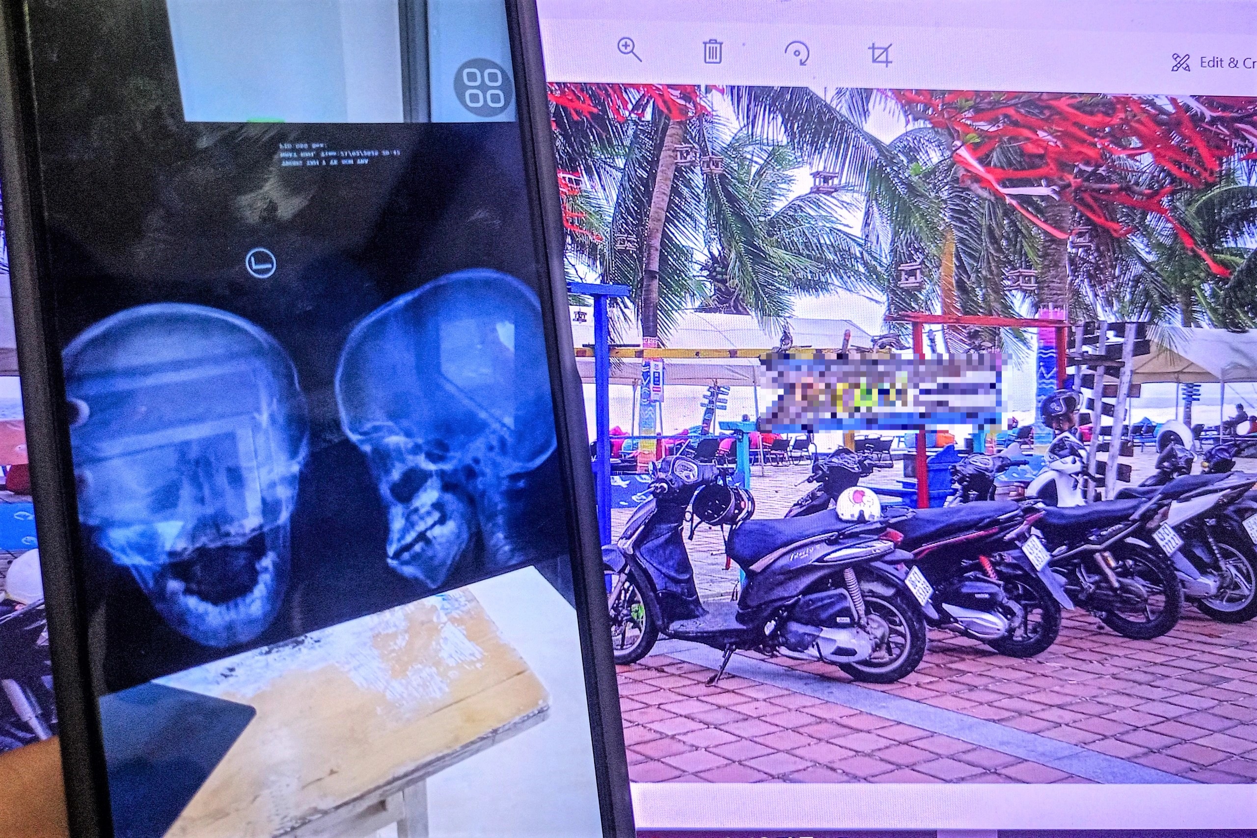 Công an xác minh thông tin chủ quán cà phê bị tố hành hung bé trai 10 tuổi