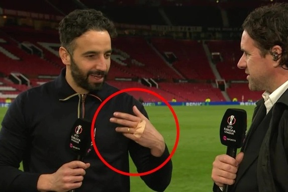 Dấu hiệu bất thường, khiến nhiều người khó hiểu của HLV Amorim