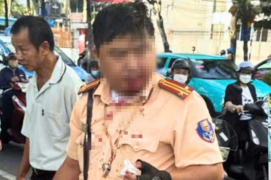 Trung tá CSGT bị người nước ngoài đấm vào mặt khi đang làm nhiệm vụ