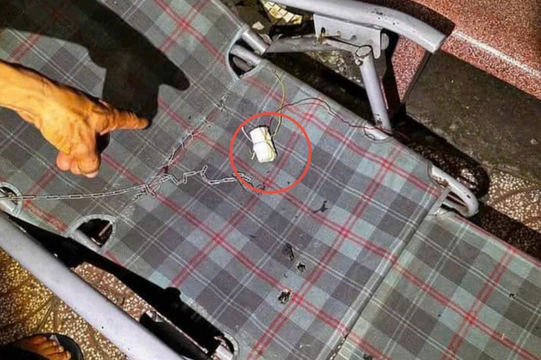 Người đàn ông 49 tuổi dập nát bàn tay sau tiếng nổ lớn ở Đồng Nai