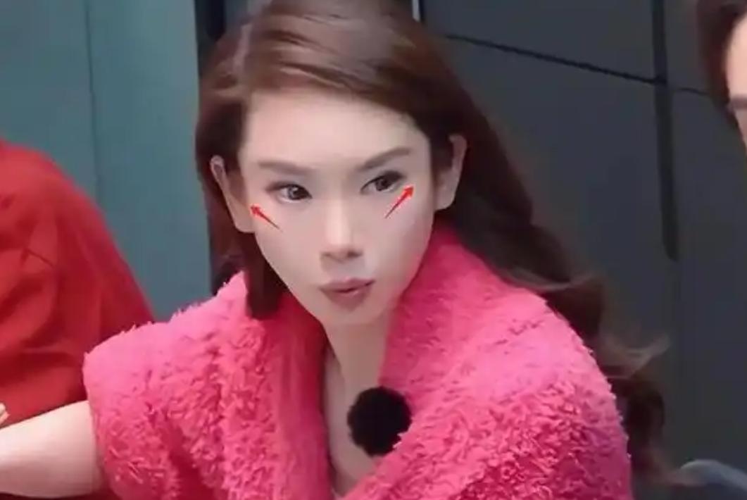 Mỹ nhân Trung Quốc thừa nhận mặt bị biến dạng vì dao kéo thẩm mỹ