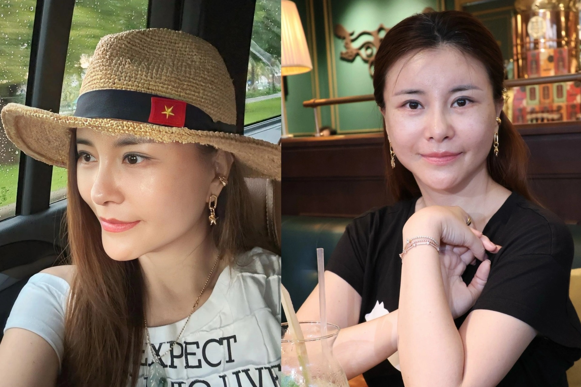 NSƯT Kim Oanh chi hơn 1 tỷ đồng phẫu thuật thẩm mỹ: "Không ngờ hot thế”