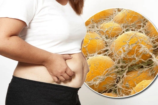 Làm thế nào để loại bỏ mỡ nội tạng nhanh chóng?