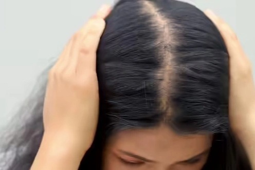 5 dấu hiệu tổn thương tóc báo hiệu vấn đề về gan và thận