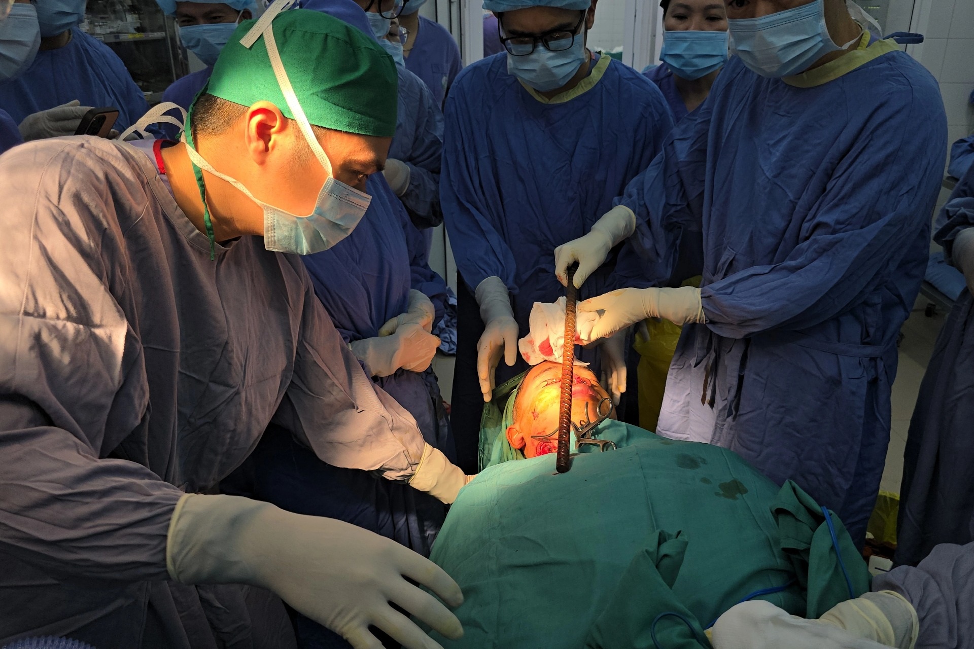 Nam sinh 16 tuổi bị thanh sắt dài 3m đâm xuyên từ đầu qua gáy