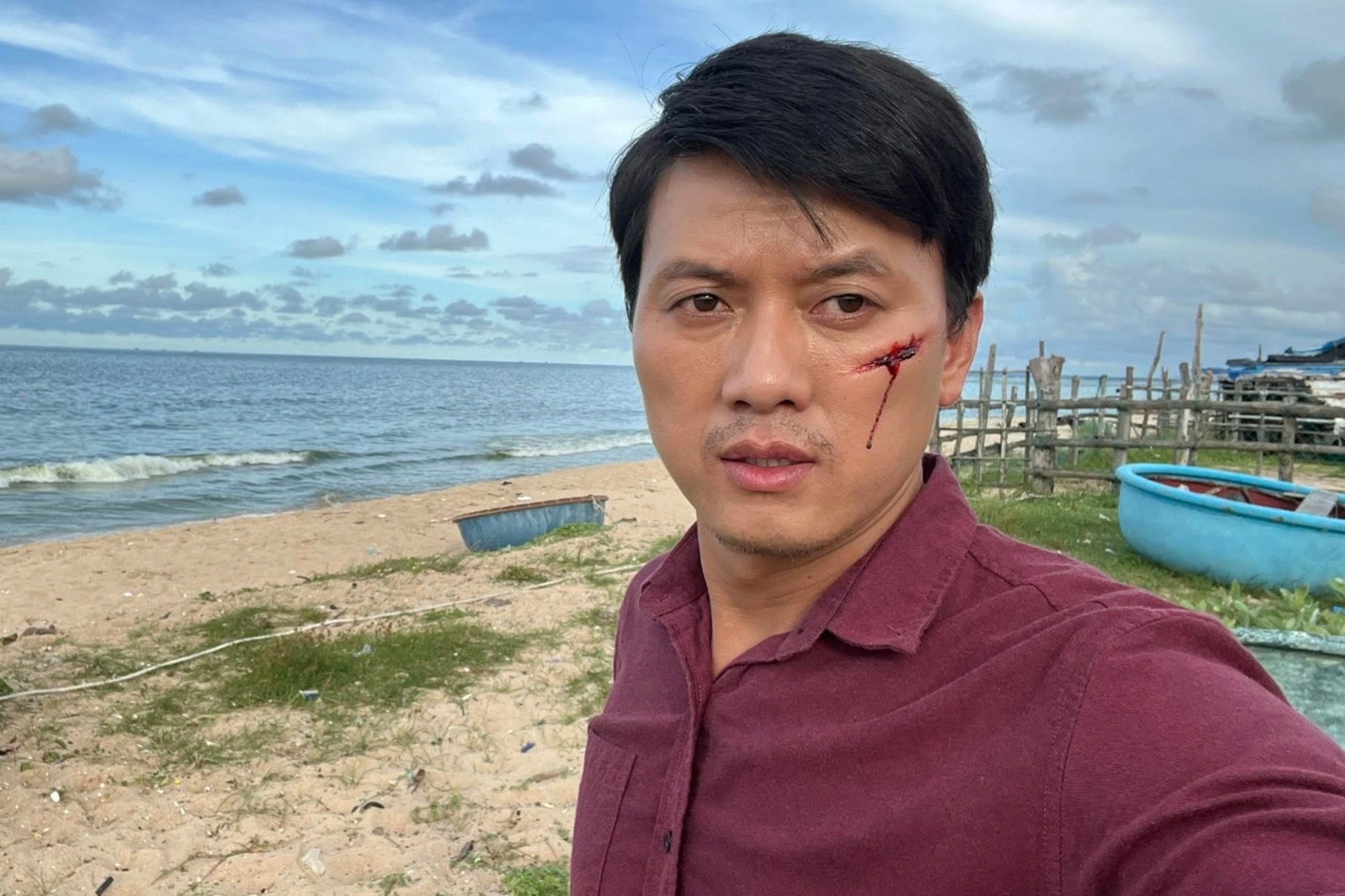 Quách Ngọc Tuyên gặp tai nạn giao thông, sức khỏe hiện ra sao?