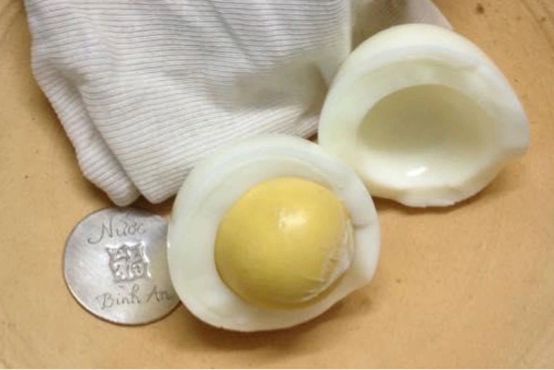 Mùa mưa bão dễ ốm sốt, có nên "đánh cảm" bằng lăn trứng gà, dây bạc?