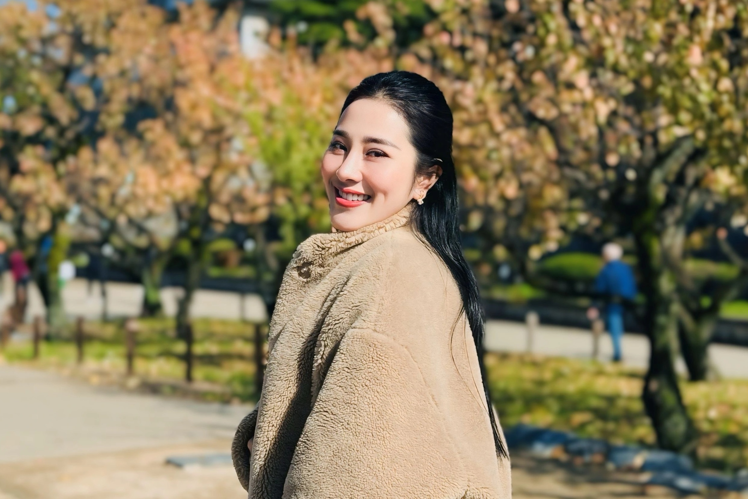 Tình trạng "ngọc nữ bolero" Tố My sau 3 tháng điều trị phình động mạch não