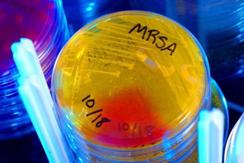 Phát hiện kháng sinh mạnh gấp 100 lần, mang hy vọng mới cho y học