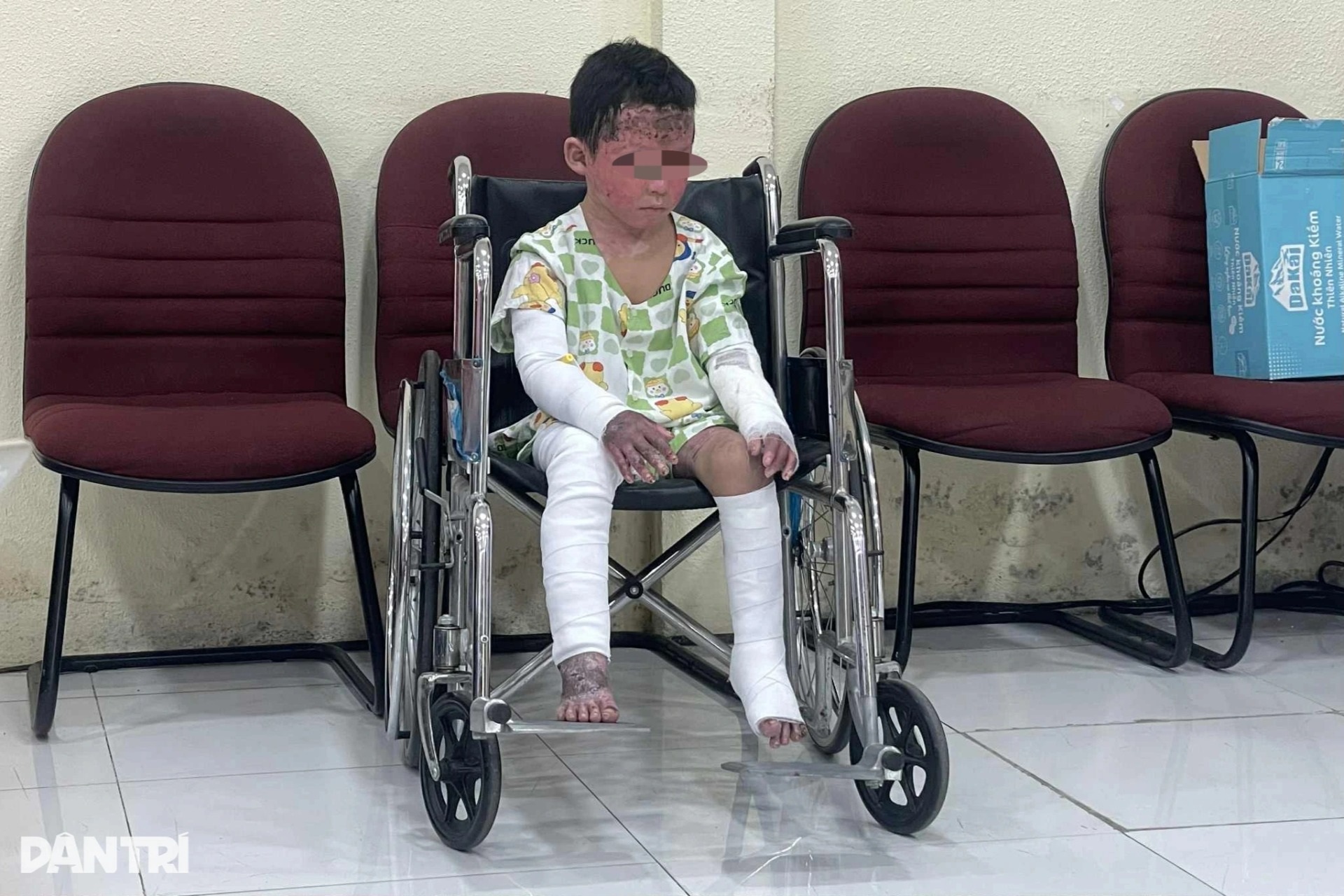 Bé trai phỏng 65% cơ thể, mồ côi cả cha lẫn mẹ sau cơn hỏa hoạn định mệnh